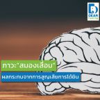 สมองเสื่อม-01